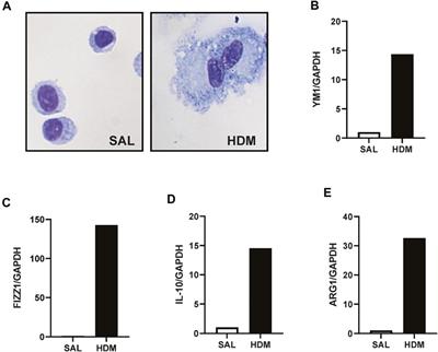 House Dust Mite Aeroallergen Suppresses Leukocyte Phagocytosis and Netosis Initiated by Pneumococcal Lung Infection